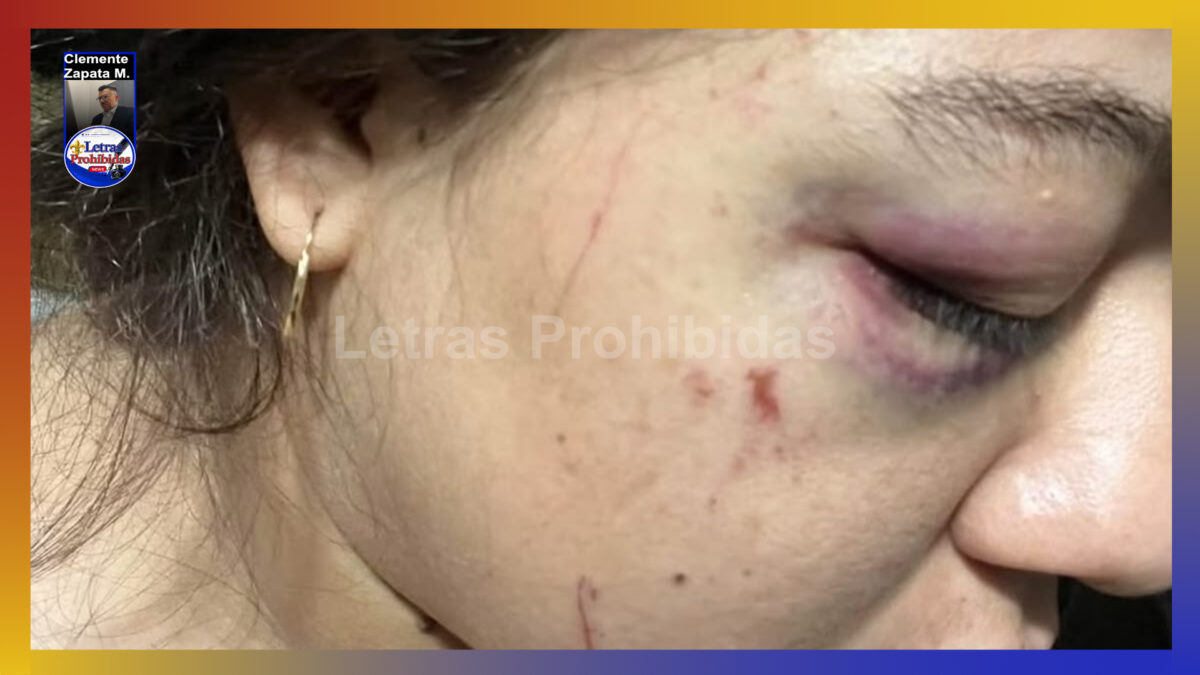 Denuncia joven mujer que pareja le puso “una tunda”
